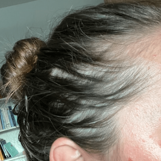 Program lasje (12)-min