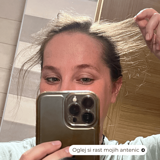 Program lasje (13)-min